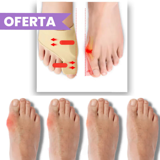 Anti Juanetes con Gel Ortopédico - 1 Par + ENVIO GRATIS
